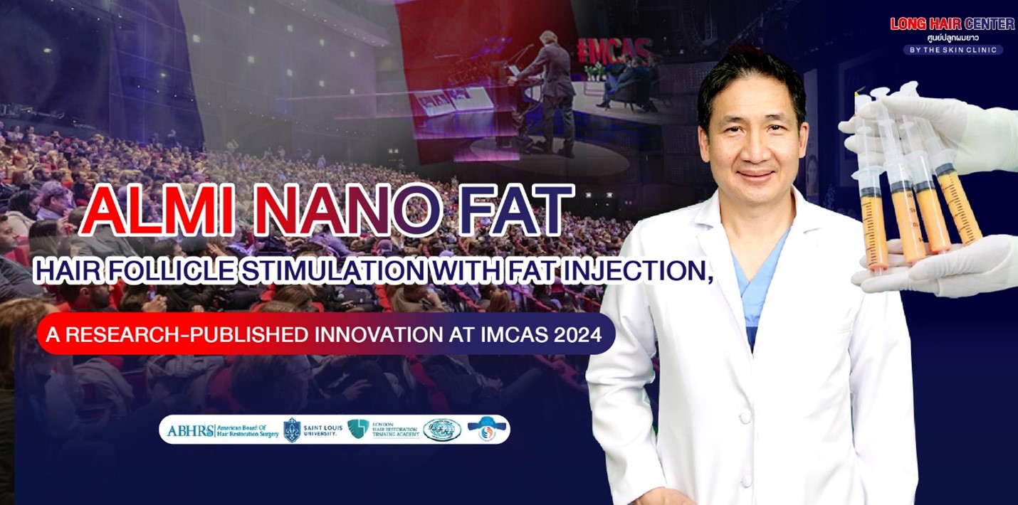 ALMI Nano Fat: Hair Follicle Stimulation with Fat Injection, A Research-Published Innovation at IMCAS 2024