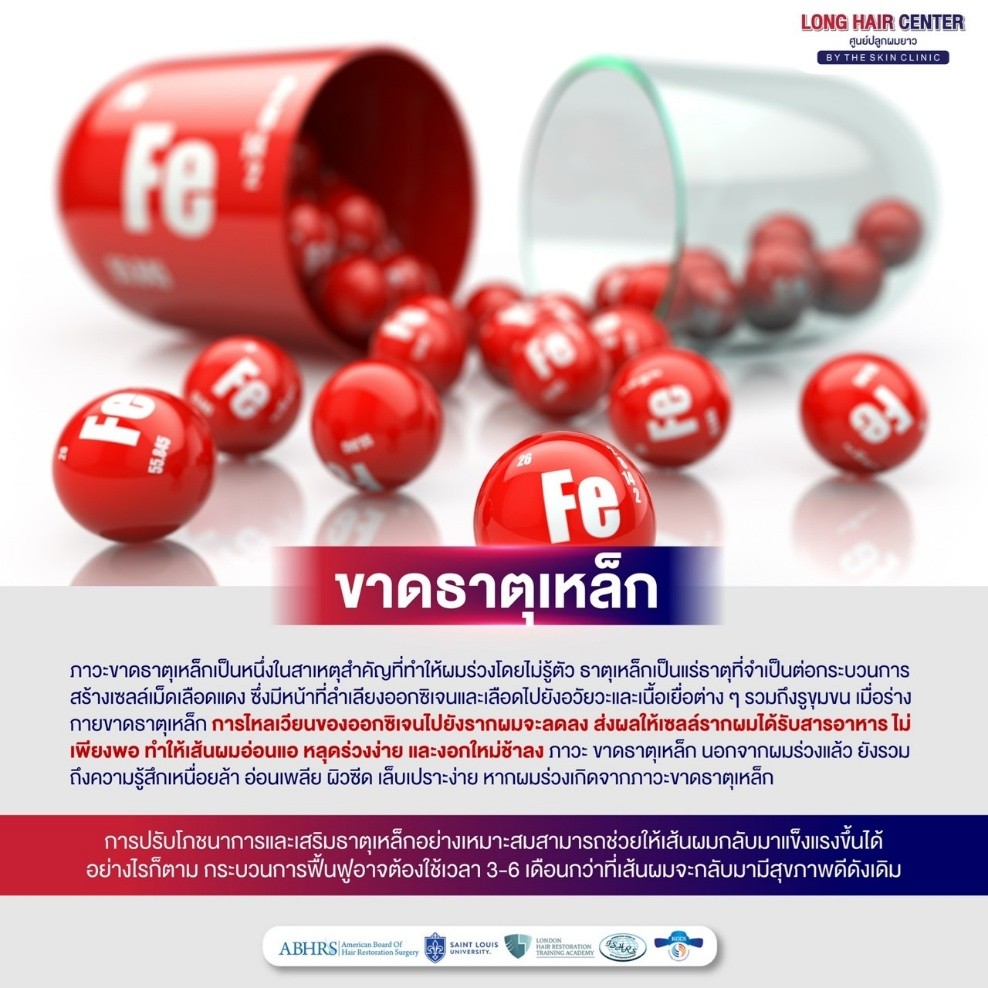 การไหลเวียนของออกซิเจนไปยังรากผมจะลดลง ส่งผลให้เซลล์รากผมได้รับสารอาหารไม่เพียงพอ ทำให้เส้นผมอ่อนแอ หลุดร่วงง่าย และงอกใหม่ช้าลง ภาวะขาดธาตุเหล็ก นอกจากผมร่วงแล้ว ยังรวมถึงความรู้สึกเหนื่อยล้า อ่อนเพลีย ผิวซีด เล็บเปราะง่าย
