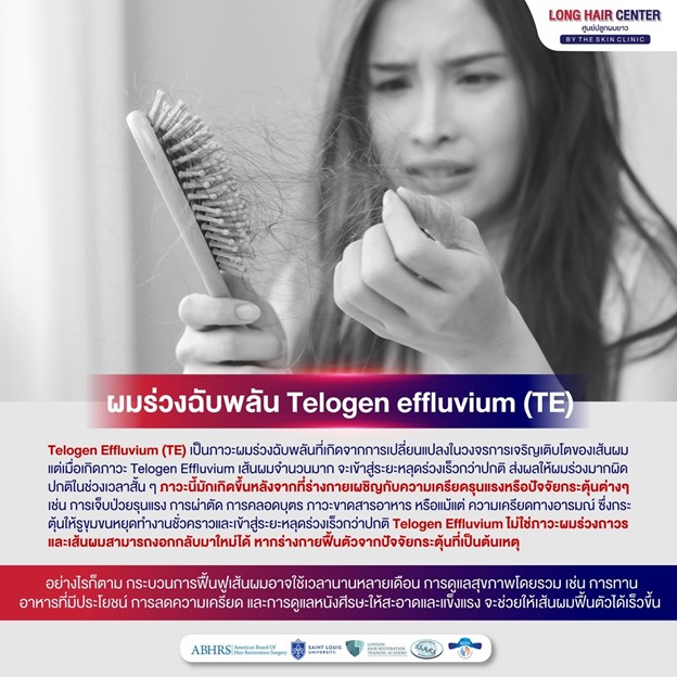 ภาวะผมร่วงเฉียบพลันที่เกิดจากการเปลี่ยนแปลงในวงจรการเจริญเติบโตของเส้นผม แต่เมื่อเกิดภาวะ Telogen Effluvium เส้นผมจำนวนมากจะเข้าสู่ระยะหลุดร่วงเร็วกว่าปกติ