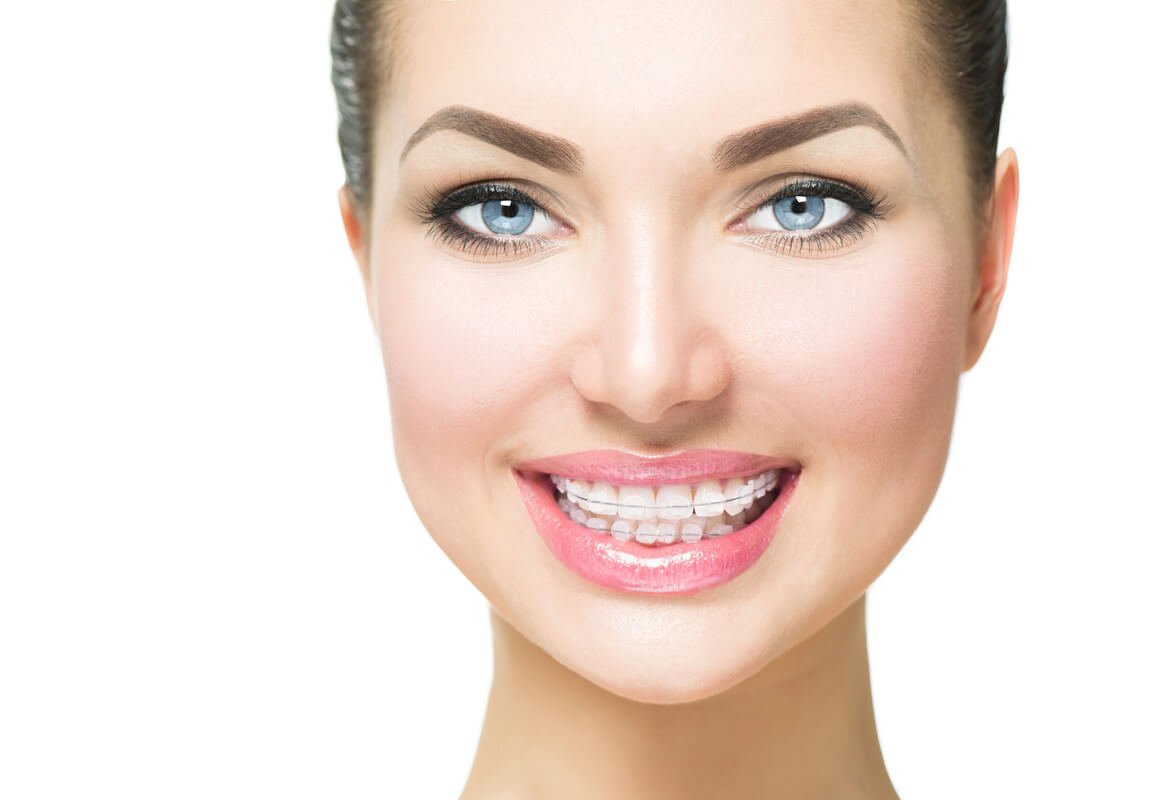 Achieve Uncompromising Smiles with Foothill Orthodontics' Clear Braces