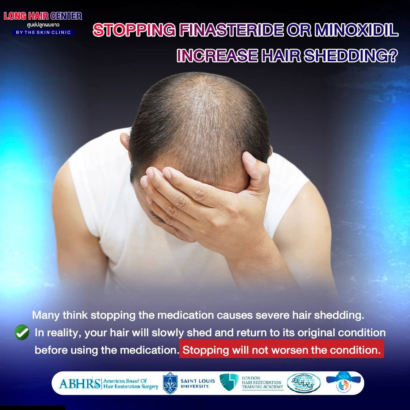 If I stop using Finasteride or Minoxidil, will my hair fall out worse than before?