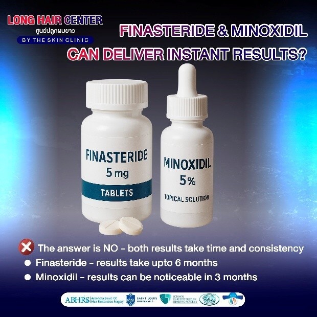 Is it true that Minoxidil only works on the crown of the head?