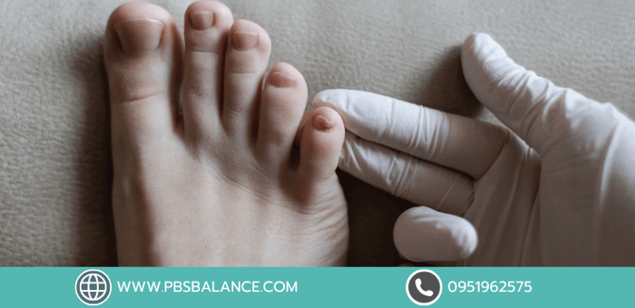 ตาปลาสัญญาณเตือนของสุขภาพเท้า