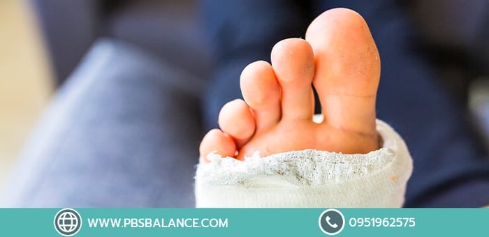 อาการปวดบริเวณโคนนิ้วเท้า