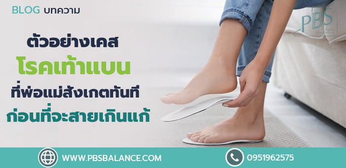 ตัวอย่างเคสโรคเท้าแบนที่พ่อแม่ควรสังเกตทันทีก่อนที่จะสายเกินแก้