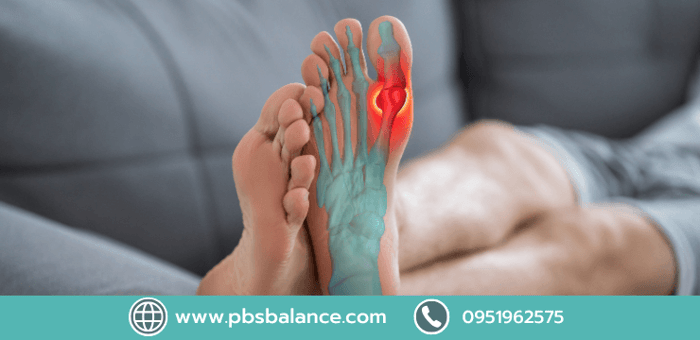 ปวดโคนนิ้วเท้า: อาการที่มักเกิดจากภาวะเท้าแบน