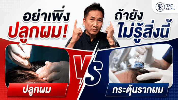 อย่าเพิ่งปลูกผม ถ้ายังไม่รู้สิ่งนี้! ปลูกผม vs กระตุ้นรากผม เลือกแบบไหนดี?