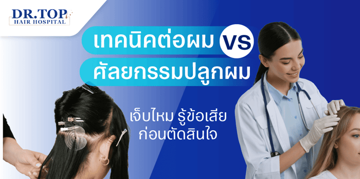 เทคนิคต่อผม vs ศัลยกรรมปลูกผม เจ็บไหม รู้ข้อเสียก่อนตัดสินใจ