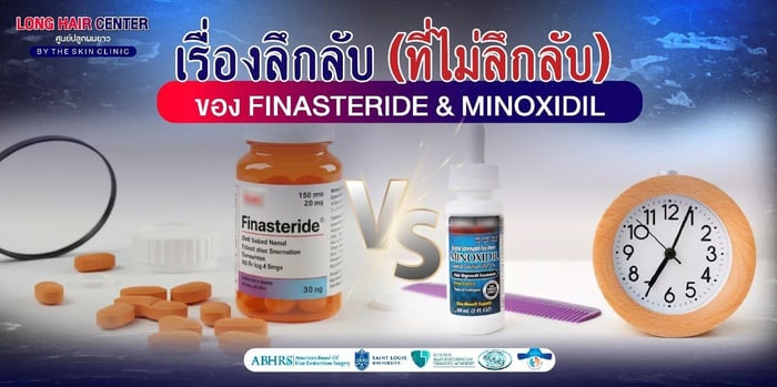 10 เรื่องลับเกี่ยวกับ Finasteride และ Minoxidil: ความจริง vs ความเชื่อผิดๆ