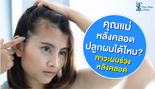 หลังคลอดผมร่วง คุณแม่หลังคลอดปลูกผมได้มั้ย?