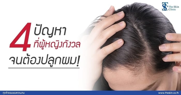 4 ปัญหา ที่ผู้หญิงกังวล จนต้องปลูกผม!!