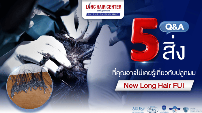 5 เรื่องที่คุณอาจไม่เคยรู้เกี่ยวกับปลูกผมเทคนิค New Long Hair ที่ The Skin Clinic?