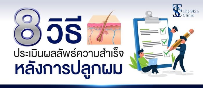 8 วิธีประเมินความสำเร็จหลังการปลูกผม…ที่คุณควรรู้?