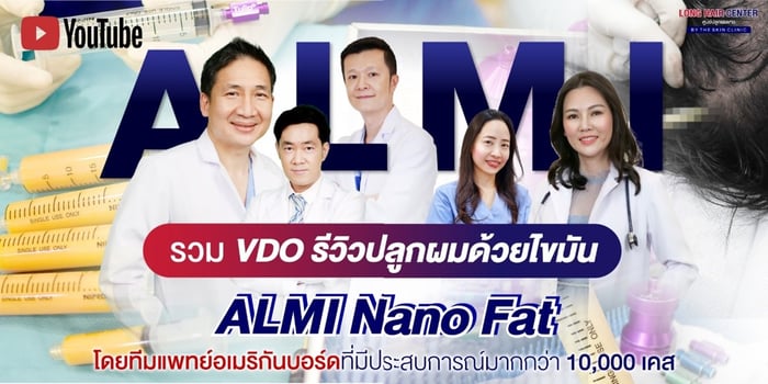 เจาะลึกเทคนิค ALMI Nanofat รีวิวรักษาผมร่วง ผมบาง ศีรษะล้าน โดยไม่ต้องปลูกผม!