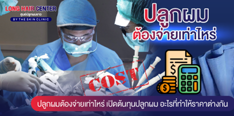 ปลูกผมต้องจ่ายเท่าไหร่? เปิดต้นทุนปลูกผม อะไรที่ทำให้ราคาต่างกัน?