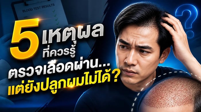 5 เหตุผลที่ควรรู้ ปลูกผมไม่ได้ แต่ตรวจเลือดผ่าน ?