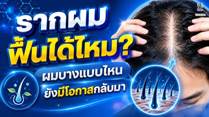 รากผมฟื้นได้ไหม? ผมบางแบบไหนยังมีโอกาสกลับมา