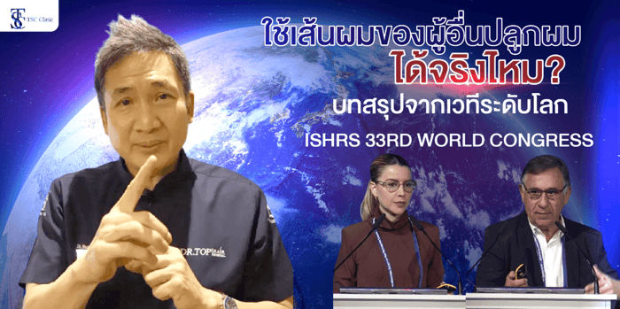 ใช้เส้นผมของคนอื่นปลูกผมได้จริงไหม? ข่าวใหญ่สะเทือนวงการปลูกผม!