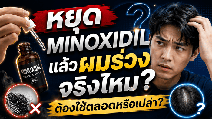 หยุด Minoxidil แล้วผมร่วงจริงไหม? ต้องใช้ตลอดหรือเปล่า