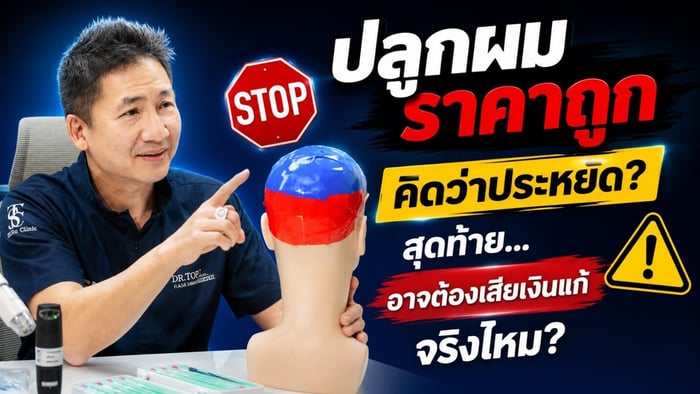 ปลูกผมราคาถูก vs ปลูกผมราคาแพง ประหยัดวันนี้ แต่อาจต้องจ่ายแพงกว่าในวันหน้า