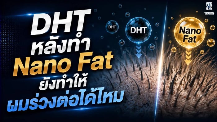 หลังทำ Nano Fat ยังทำให้ผมร่วงต่อได้ไหม