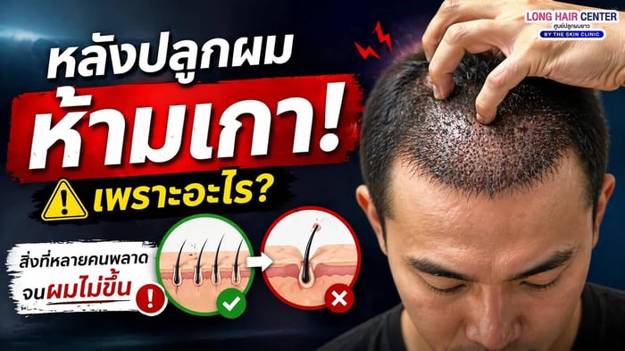 หลังปลูกผม ห้ามเกา เพราะอะไร? สิ่งที่หลายคนพลาดจนผมไม่ขึ้น