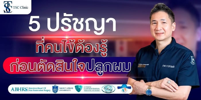 อย่าเพิ่งปลูกผมถ้ายังไม่ได้อ่าน! 5 ปรัชญาที่ต้องรู้ ก่อนจะก้าวเข้าสู่การปลูกผม