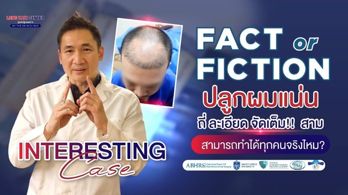 ปลูกผมแน่น ถี่ ละเอียด จัดเต็ม สามารถทำได้ทุกคนจริงไหม?