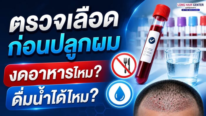 ตรวจเลือดก่อนปลูกผม งดอาหารไหม? ดื่มน้ำได้ไหม