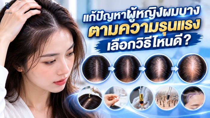 แก้ปัญหาผู้หญิงผมบางตามความรุนแรง The Skin Clinic