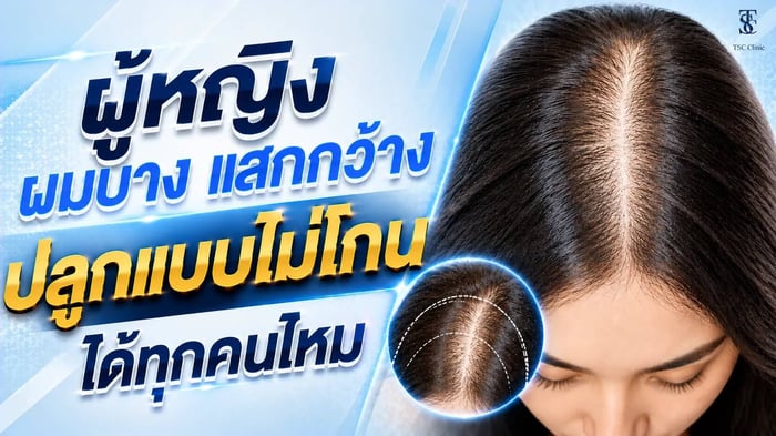 ผมบางแสกกว้างปลูกไม่โกน ผู้หญิงเหมาะกับทุกคนไหม