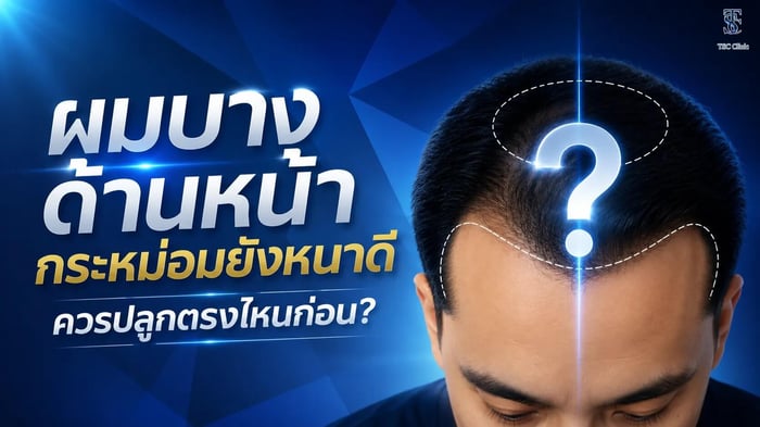 ผมบางด้านหน้า กระหม่อมยังหนาดี ควรปลูกตรงไหนก่อน?