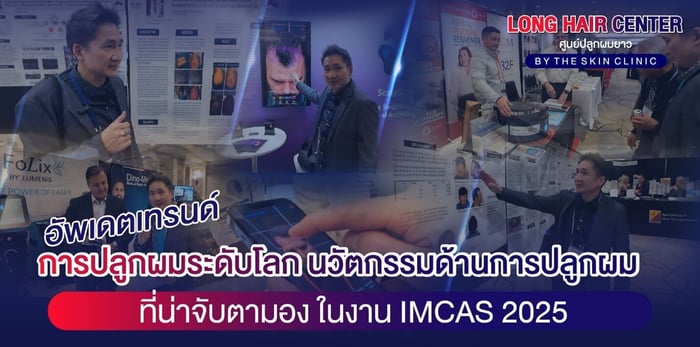 อัปเดตเทรนด์การปลูกผมระดับโลก นวัตกรรมด้านการปลูกผมที่น่าจับตามอง ในงาน IMCAS 2025
