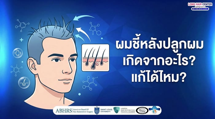 ผมชี้หลังปลูกผม เกิดจากอะไร แก้ได้ไหม?