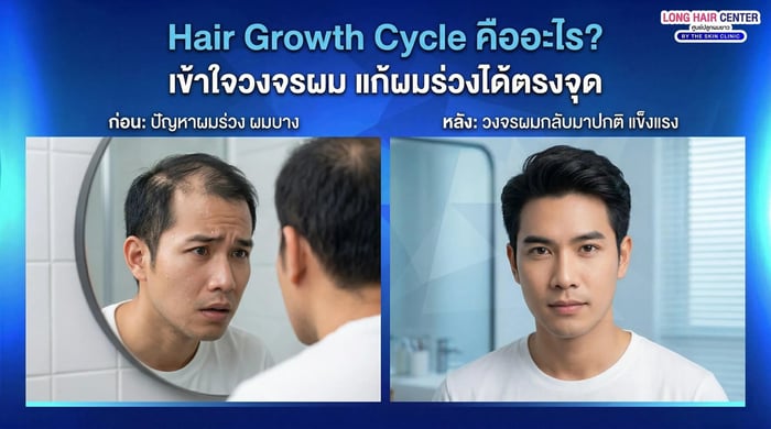 Hair Growth Cycle คืออะไร? เข้าใจวงจรผม แก้ผมร่วงได้ตรงจุด