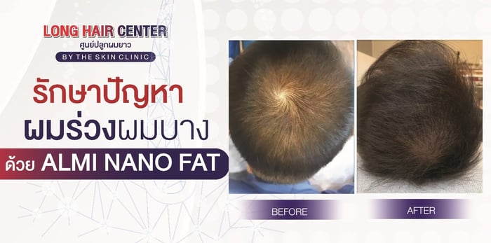 dr-top-hair-hospital-was-a-keynote-speaker-at-a world-renowned-hair-transplant