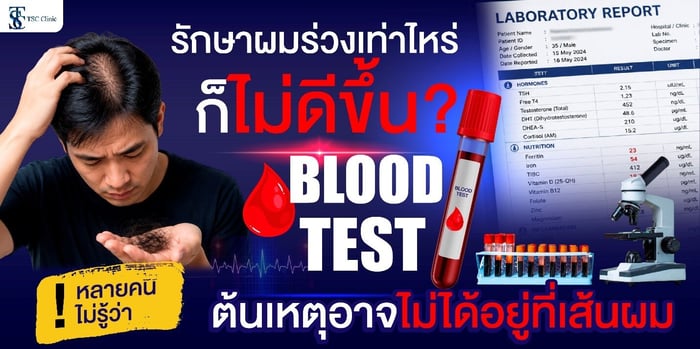 เจาะลึกสาเหตุผมร่วง ! ทำไมต้อง “ตรวจเลือด” ก่อนเริ่มรักษา?
