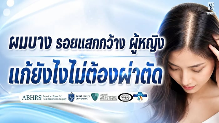 ผมบาง รอยแสกกว้าง ผู้หญิง แก้ยังไงไม่ต้องผ่าตัด