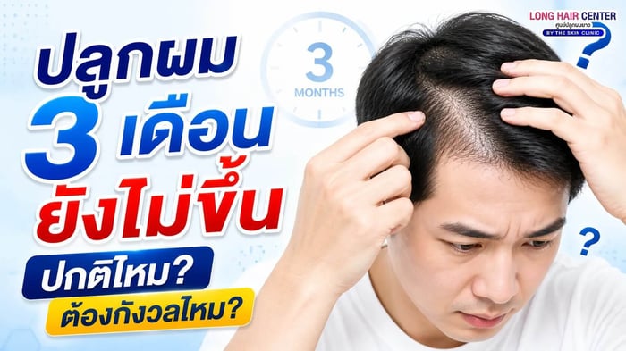 ปลูกผม 3 เดือนยังไม่ขึ้น ปกติไหม? ต้องกังวลไหม