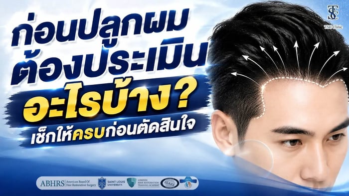 ก่อนปลูกผมต้องประเมินอะไรบ้าง? เช็กให้ครบก่อนตัดสินใจ