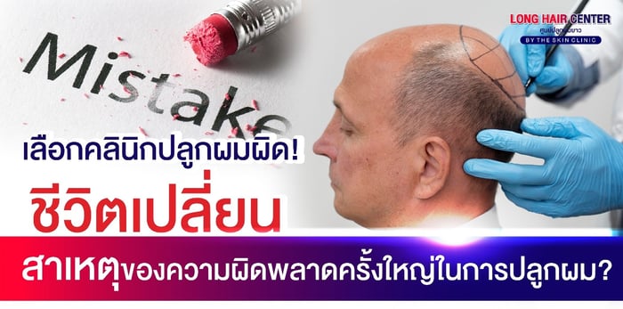 dr-top-hair-hospital-was-a-keynote-speaker-at-a world-renowned-hair-transplant