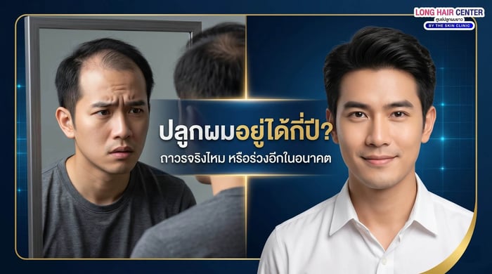 ปลูกผมอยู่ได้ถาวรไหม? ทำไมบางคนร่วงอีก