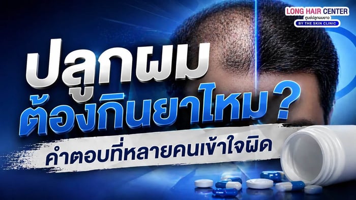ปลูกผมต้องกินยาไหม? คำตอบที่หลายคนเข้าใจผิด