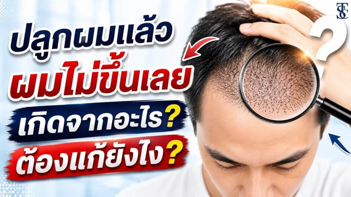 ปลูกผมแล้วผมไม่ขึ้นเลย เกิดจากอะไร? ต้องแก้ยังไง
