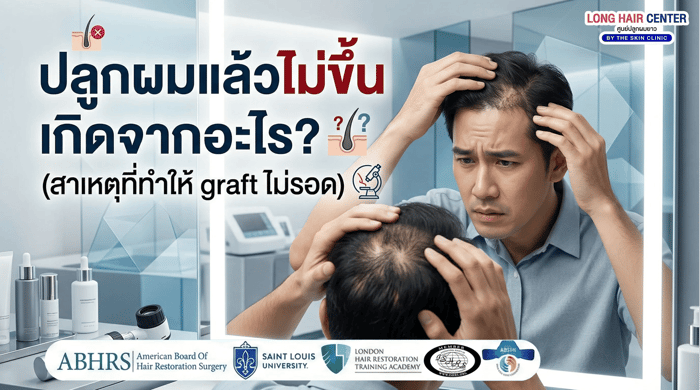 ปลูกผมแล้วไม่ขึ้น เพราะอะไร? ระวังพลาดต้องแก้ซ้ำ