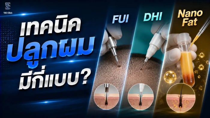 เทคนิคปลูกผม FUI Long Hair FUI DHI และ Nano Fat เปรียบเทียบกัน