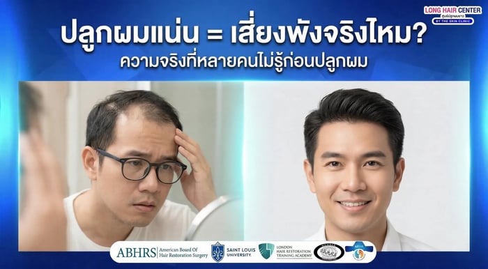 ปลูกผมแน่นเกินไป อันตรายไหม? ความจริงที่หลายคนไม่รู้ก่อนปลูก