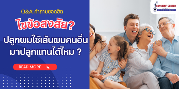 ไขข้อสงสัยเกี่ยวกับการปลูกผม ปลูกผมด้วยเส้นผมของคนอื่นทำได้หรือไม่?