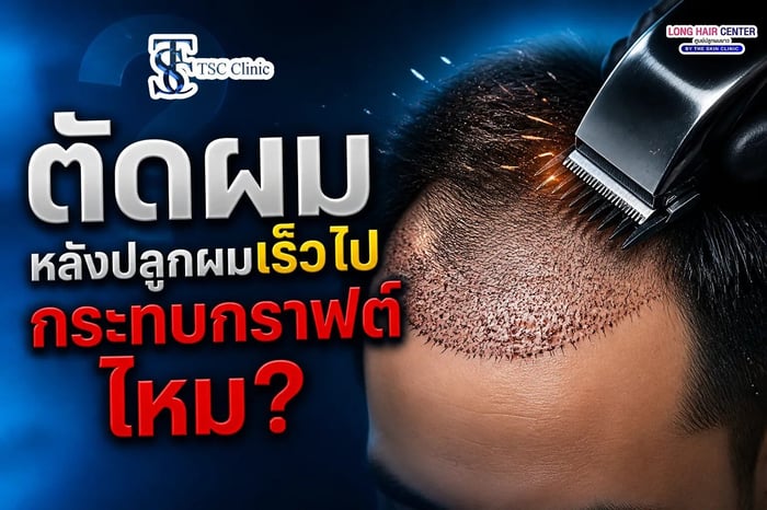 ตัดผมหลังปลูกผมเร็วไป กระทบกราฟต์ไหม