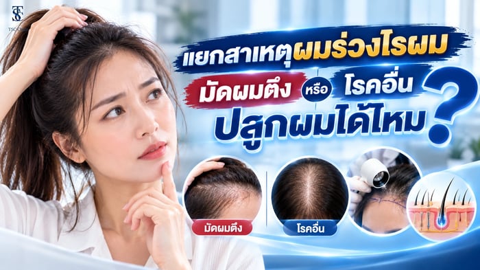 เปรียบเทียบผมร่วงบริเวณไรผมและขมับจากการมัดผมตึงกับสาเหตุอื่น